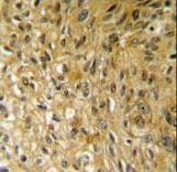 SAMSN1 Antibody (aa255-283)