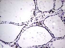NBN / Nibrin Antibody (clone OTI6E11)