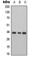 PathPlus™ Polyclonal Rabbit anti-Human CTSB / Cathepsin B Antibody (Internal, IHC, WB)