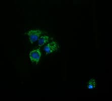 ACAA2 Antibody (clone OTI2G6)