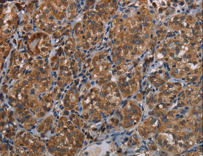LLGL1 / HUGL Antibody
