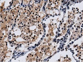 NT5DC1 Antibody (clone OTI3A6)
