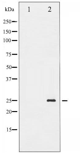 TNNI3 / Cardiac Troponin I Antibody (phospho-Ser43)