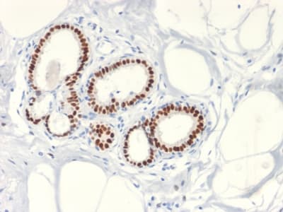 Recombinant Monoclonal Rabbit anti-Human ER Alpha / Estrogen Receptor Antibody (clone ESR1/2299R, IHC, WB)