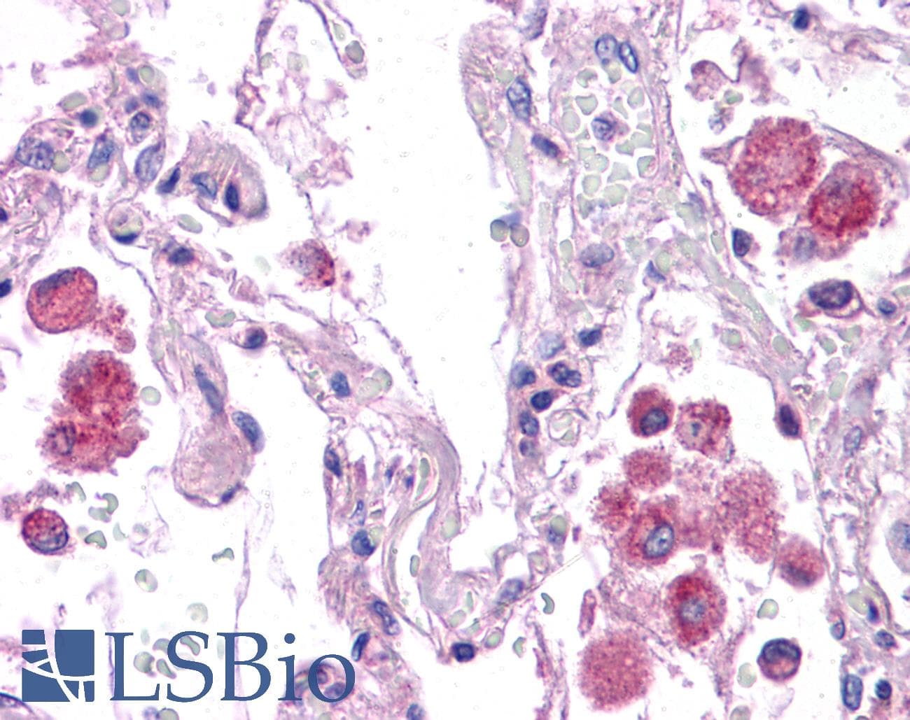 HNF1A / HNF1 Antibody (aa179-228)