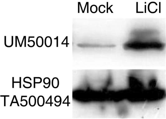CTNNB1 / Beta Catenin Antibody (clone UMAB14)