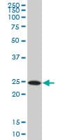 Monoclonal Mouse anti-Human APG5 / ATG5 Antibody (clone 1E7, WB)