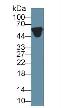 ORM1 / Orosomucoid Antibody (aa19-201)