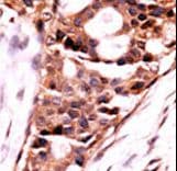 Polyclonal Rabbit anti-Human PPP3CB Antibody (aa1-30, IHC, WB)