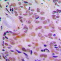 Polyclonal Rabbit anti-Human CHEK2 / CHK2 Antibody (N-Terminus, IHC, IF, WB)