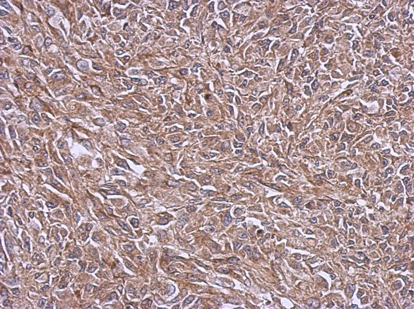 NDUFB4 / B15 Antibody