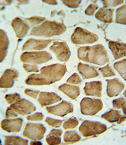Polyclonal Rabbit anti-Human CA3 / Carbonic Anhydrase III Antibody (aa146-177, IHC, WB)
