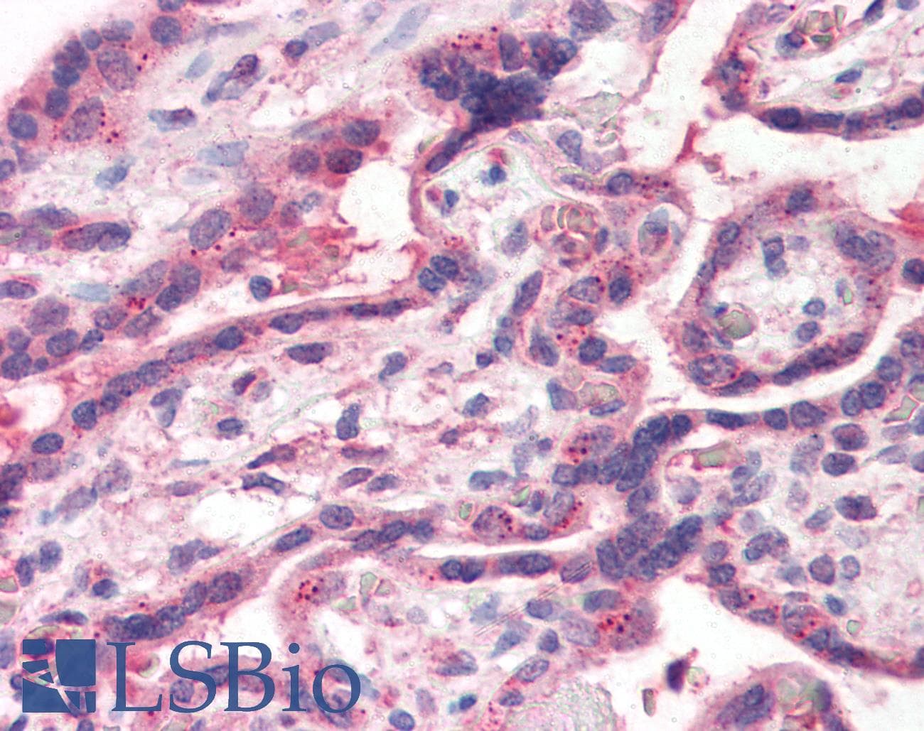 IHC-plus™ TFF2 / SP Antibody (Internal)