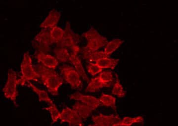 RBM26 / SE70 Antibody