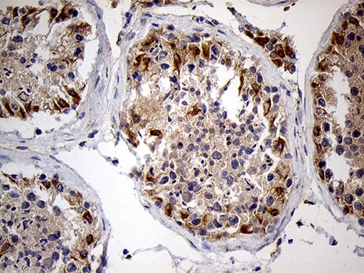Monoclonal Mouse anti-Human ZFP57 Antibody (clone OTI1E2, Carrier-free, IHC, WB)