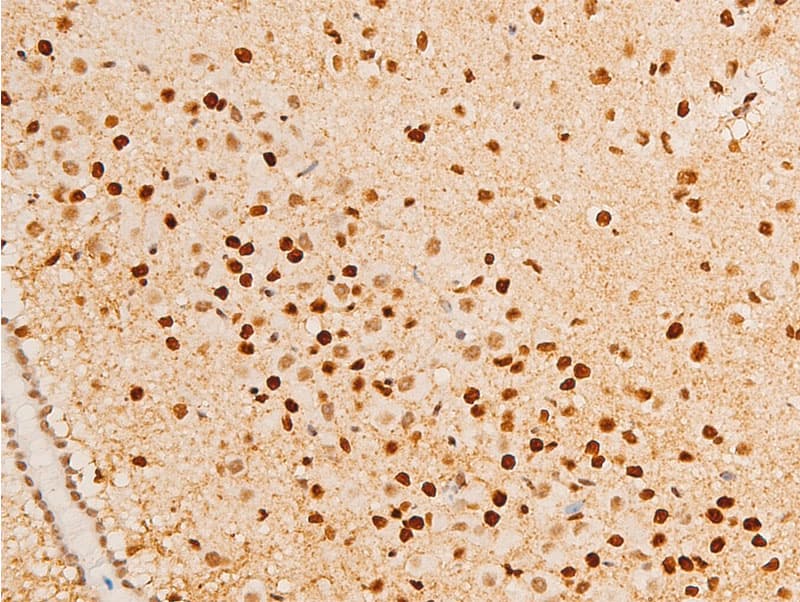NR3C1/Glucocorticoid Receptor Antibody (phospho-Ser203)