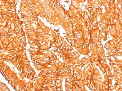 Recombinant Monoclonal Rabbit anti-Human EPCAM Antibody (clone EGP40/1556R, Azide-free,Carrier-free, IHC, IF)