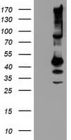 SERPINB13 / HUR7 Antibody (clone OTI2B6)