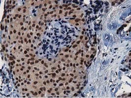 NT5DC1 Antibody (clone OTI2A1)