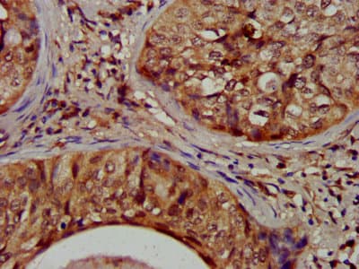 NIT1 Antibody