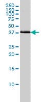 IHC-plus™ BAG1 / BAG-1 Antibody (clone 2D3)