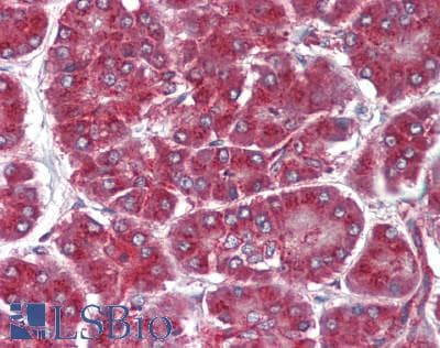 IHC-plus™ Polyclonal Rabbit anti-Human ZDHHC2 Antibody (IHC, IF)