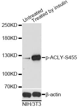 ACLY / ATP Citrate Lyase Antibody (phospho-Ser455)