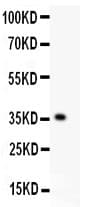 KLF6 Antibody (aa38-205)