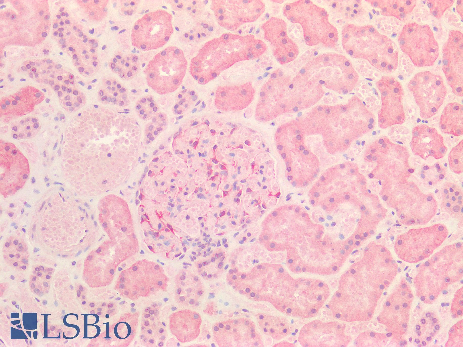 PathPlus™ Polyclonal Rabbit anti-Human INSR / Insulin Receptor Antibody (Internal, IHC)