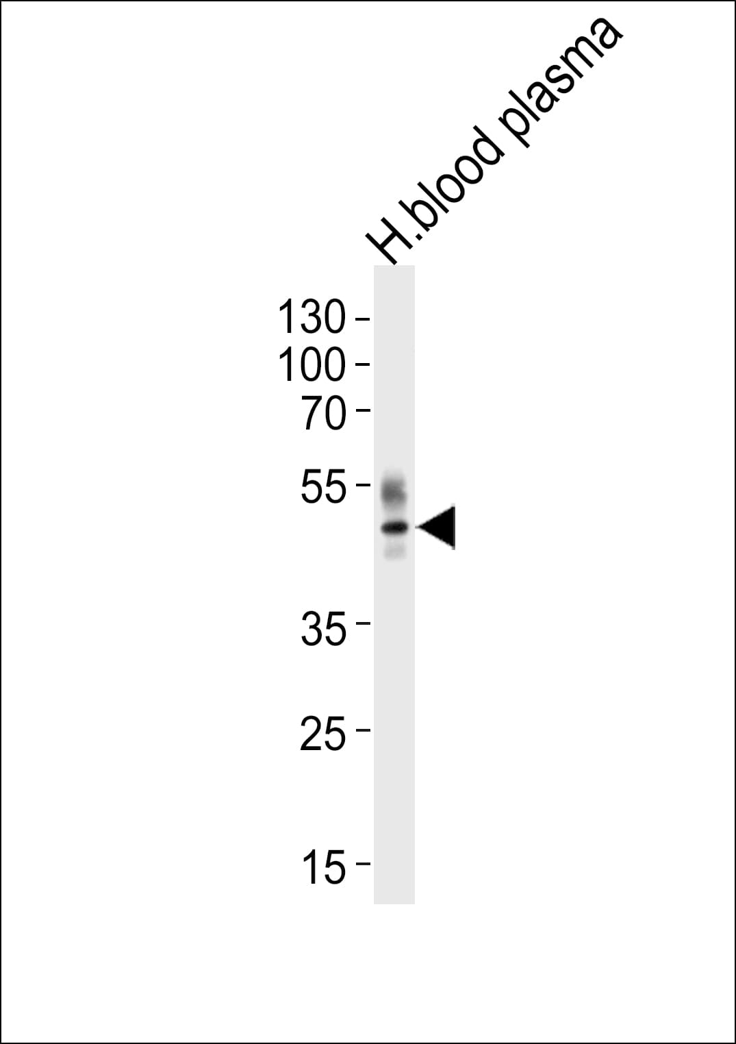 IHC-plus™ Polyclonal Rabbit anti-Human PON1 / ESA Antibody (aa118-145, IHC, WB)