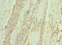 Polyclonal Rabbit anti-Human IL7R / CD127 Antibody (aa21-239, IHC, WB)