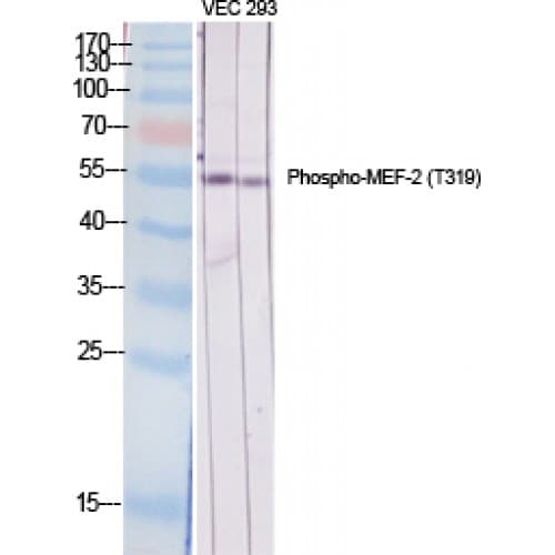 Polyclonal Rabbit anti-Human MEF2A / MEF2 Antibody (260-340 aa, IHC, WB)