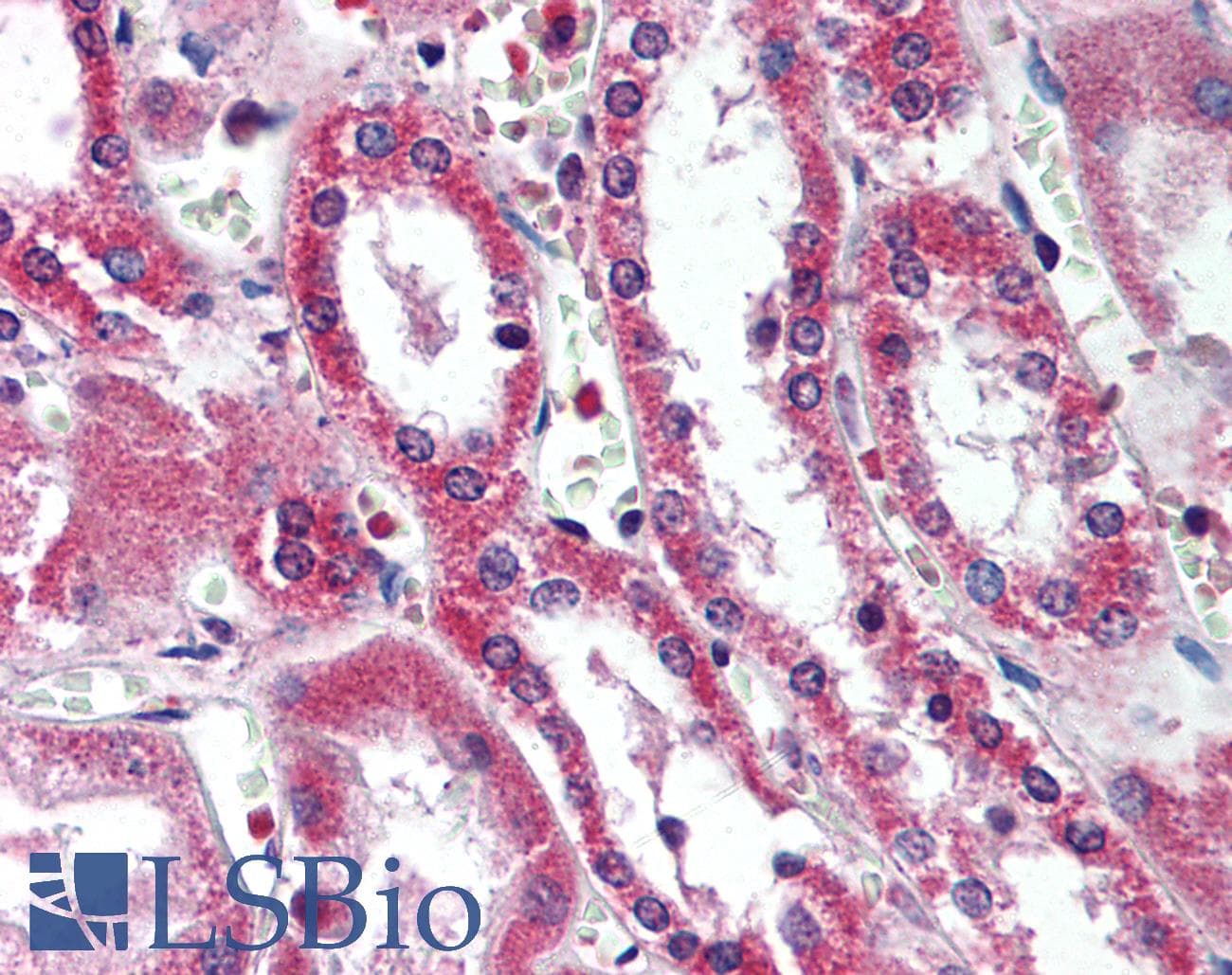 IHC-plus™ Polyclonal Rabbit anti-Human SIRT5 / Sirtuin 5 Antibody (aa30-46, IHC, WB)