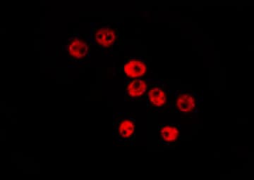 Polyclonal Rabbit anti-Human ID / ID1 Antibody (IHC, IF, WB)
