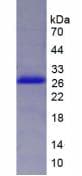 Human DVL2 / Dishevelled 2 Protein (Recombinant His-T7)