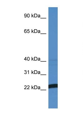 Polyclonal Rabbit anti-Human EFNA4 / Ephrin A4 Antibody (aa63-112, WB)