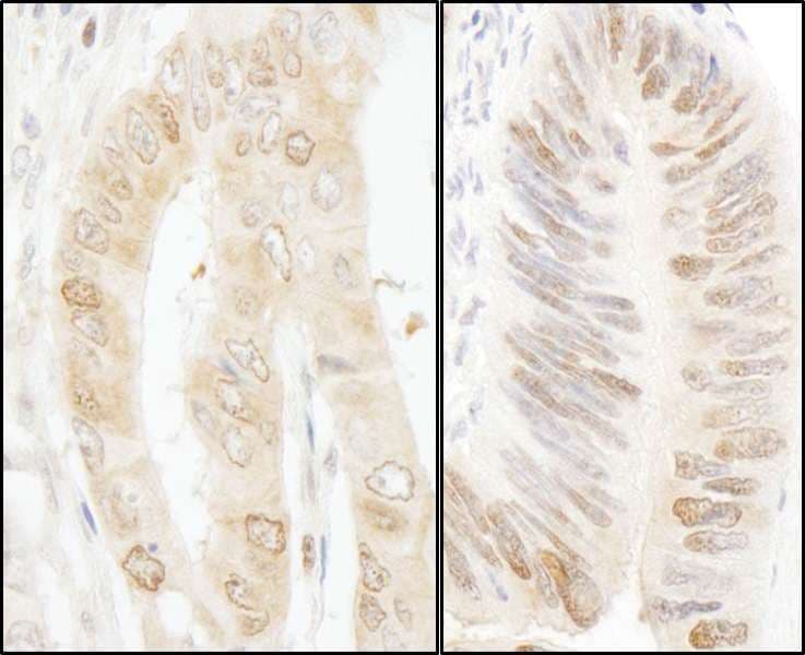 Polyclonal Rabbit anti-Human RANBP1 Antibody (aa1-50, IHC, WB)