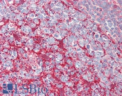 IHC-plus™ REG3G Antibody