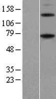 Human ENTPD4 / LALP70 Protein (Over-Expression Lysate Myc-DDK (Flag))