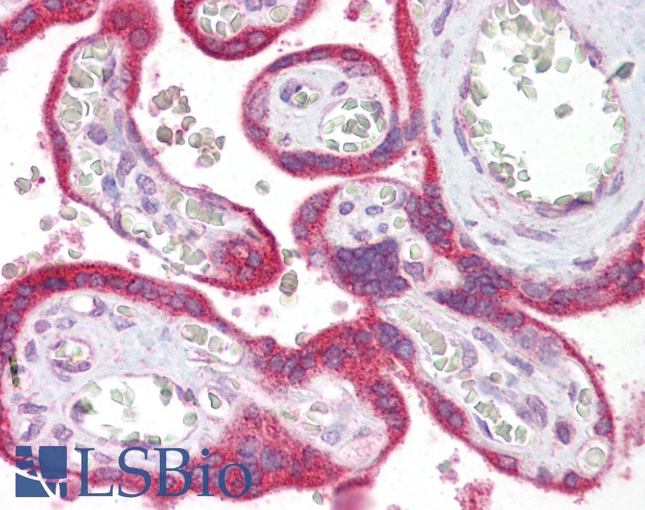 IHC-plus™ Polyclonal Rabbit anti-Human VPS39 Antibody (IHC, IF, WB)