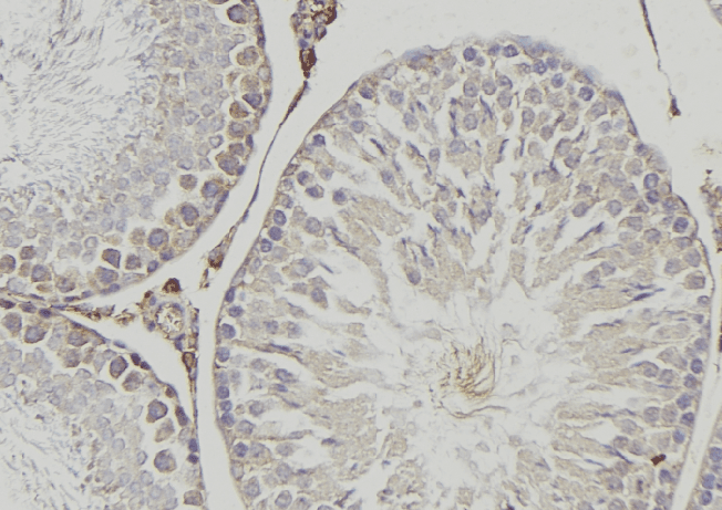 FH / Fumarase / MCL Antibody