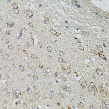 DGUOK / Deoxyguanosine Kinase Antibody