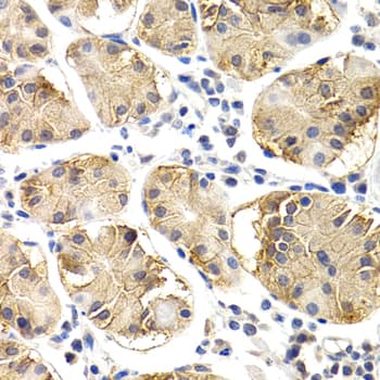 Polyclonal Rabbit anti-Human CHIT1 / Chitotriosidase Antibody (IHC, WB)