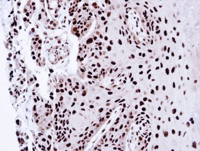 PSME3 Antibody (aa1-254)