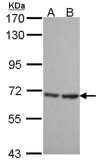 Polyclonal Rabbit anti-Human SH3BP1 Antibody (aa639-701, IHC, WB)