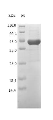 Mycoplasma genitalium p37 Protein (Recombinant 10His, N-terminus + Myc, C-terminus)