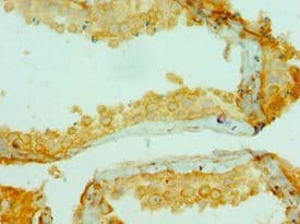 COL10A1 / Collagen X Antibody (aa521-680)