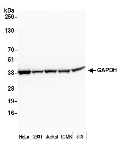 IHC-plus™ Polyclonal Rabbit anti-Human GAPDH Antibody (aa250-300, IHC, WB)