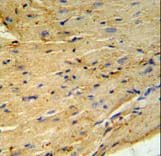 Polyclonal Rabbit anti-Human PLN / Phospholamban Antibody (aa1-30, IHC, WB)