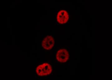 PSMA3 Antibody